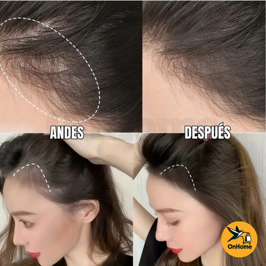 SOMBRA CAPILAR - SUAKE - CUBRE ESPACIOS POR CALVICIE Y CANAS😎