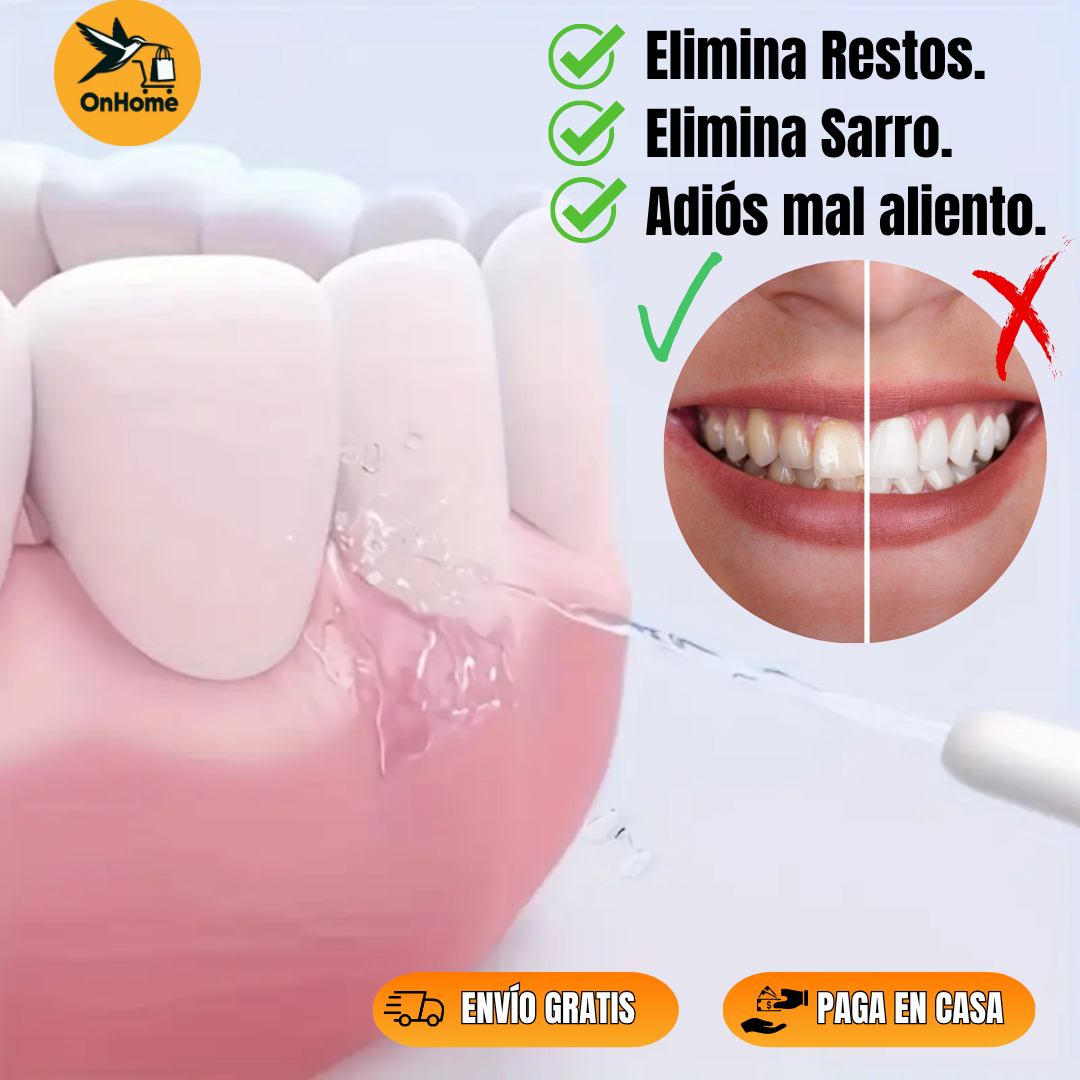 IRRIGADOR BUCAL RECARGABLE - ✨Elimina Bacterias Donde Tu Cepillo No Llega👄