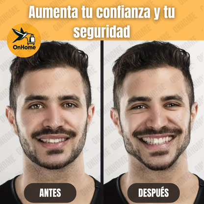 EJERCITADOR DE MANDÍBULA - PACK X 4 PARES 😏